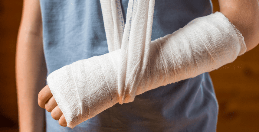 broken-arm-m (2)